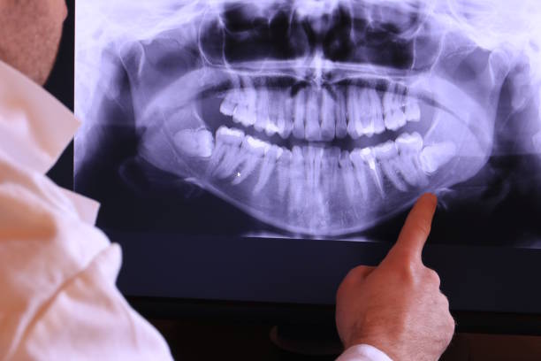 Best Emergency Dental Care for Broken or Chipped Teeth in Northfield, OH